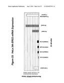 RNA INTERFERENCE MEDIATED INHIBITION OF CHROMOSOME TRANSLOCATION GENE EXPRESSION USING SHORT INTERFERING NUCLEIC ACID (siNA) diagram and image