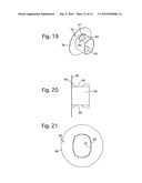 PUNCTURE NEEDLE DEVICE FOR ULTRASONIC ENDOSCOPE diagram and image