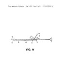 SLOTTED CLEAR CANNULA diagram and image