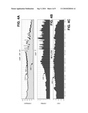 CEREBRAL VASCULAR REACTIVITY MONITORING diagram and image