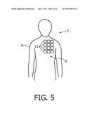 SYSTEM AND METHOD OF POSITIONING A SENSOR FOR ACQUIRING A VITAL PARAMETER OF A SUBJECT diagram and image