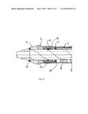 Catheter for conducting a procedure within a lumen, duct or organ of a living being diagram and image