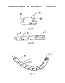 Catheter for conducting a procedure within a lumen, duct or organ of a living being diagram and image