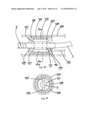 Catheter for conducting a procedure within a lumen, duct or organ of a living being diagram and image