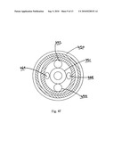 Catheter for conducting a procedure within a lumen, duct or organ of a living being diagram and image