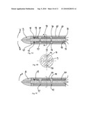 Catheter for conducting a procedure within a lumen, duct or organ of a living being diagram and image