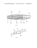 Catheter for conducting a procedure within a lumen, duct or organ of a living being diagram and image