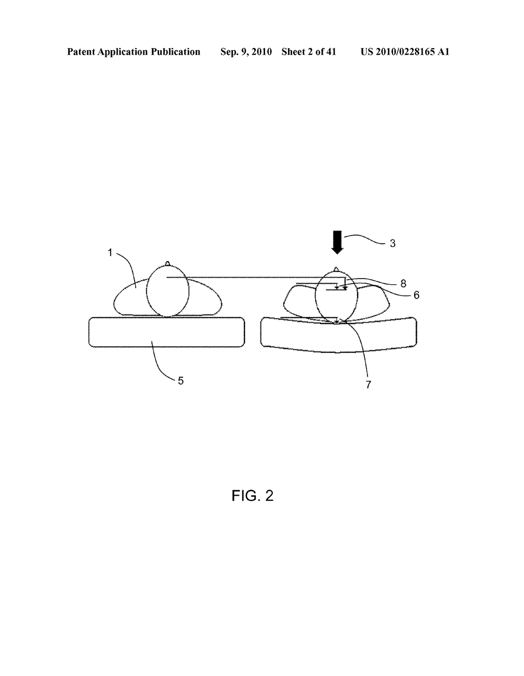 MEASUREMENT OF A COMPRESSION PARAMETER FOR CPR ON A SURFACE - diagram, schematic, and image 03