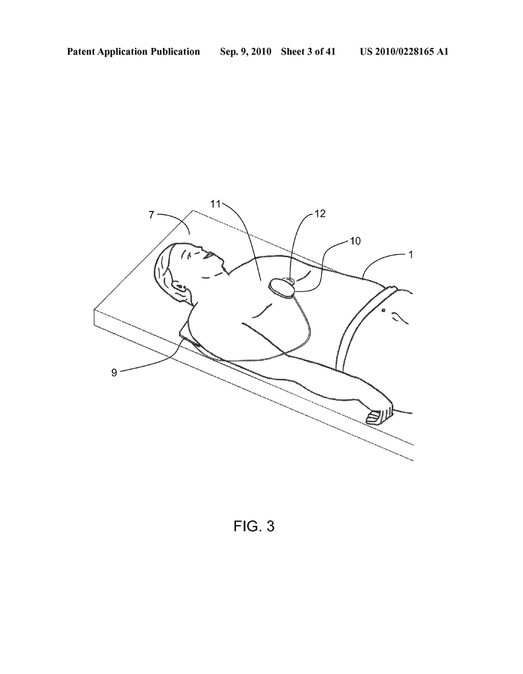 MEASUREMENT OF A COMPRESSION PARAMETER FOR CPR ON A SURFACE - diagram, schematic, and image 04