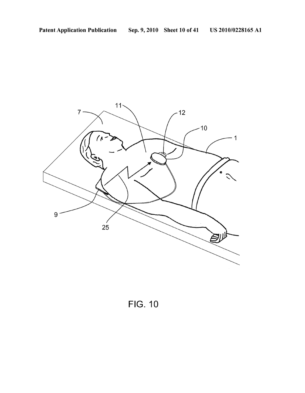 MEASUREMENT OF A COMPRESSION PARAMETER FOR CPR ON A SURFACE - diagram, schematic, and image 11