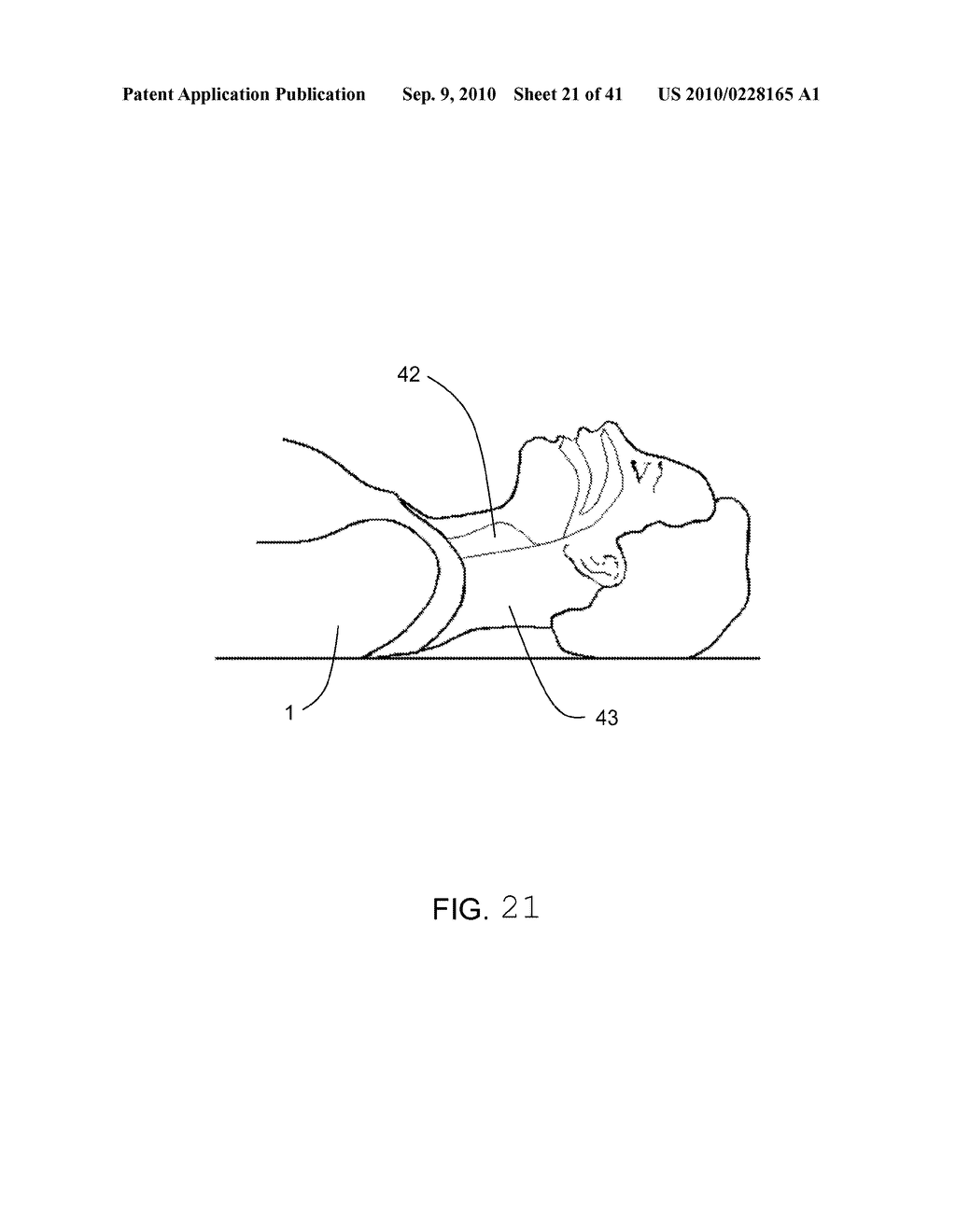 MEASUREMENT OF A COMPRESSION PARAMETER FOR CPR ON A SURFACE - diagram, schematic, and image 22