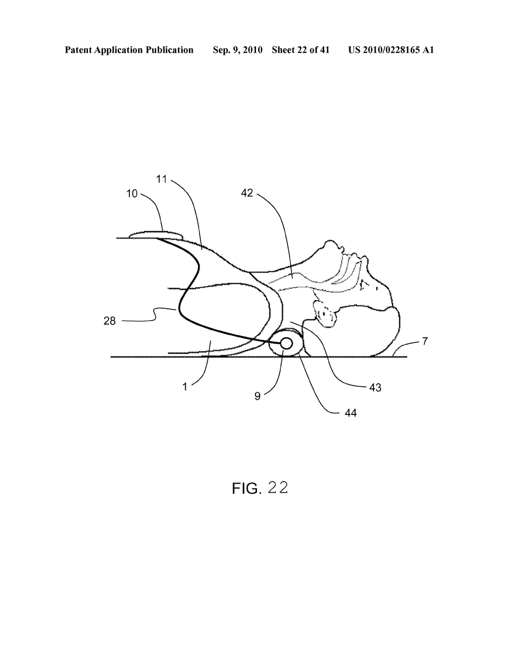 MEASUREMENT OF A COMPRESSION PARAMETER FOR CPR ON A SURFACE - diagram, schematic, and image 23