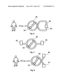 SINGLE-NEEDLE DIALYSIS SYTEM UTILIZING A PERISTALTIC PUMP WITH PUMPING AND OCCLUDING ROLLERS diagram and image