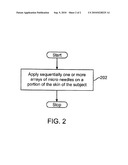 METHOD AND SYSTEM FOR DELIVERY OF NEUROTOXINS diagram and image