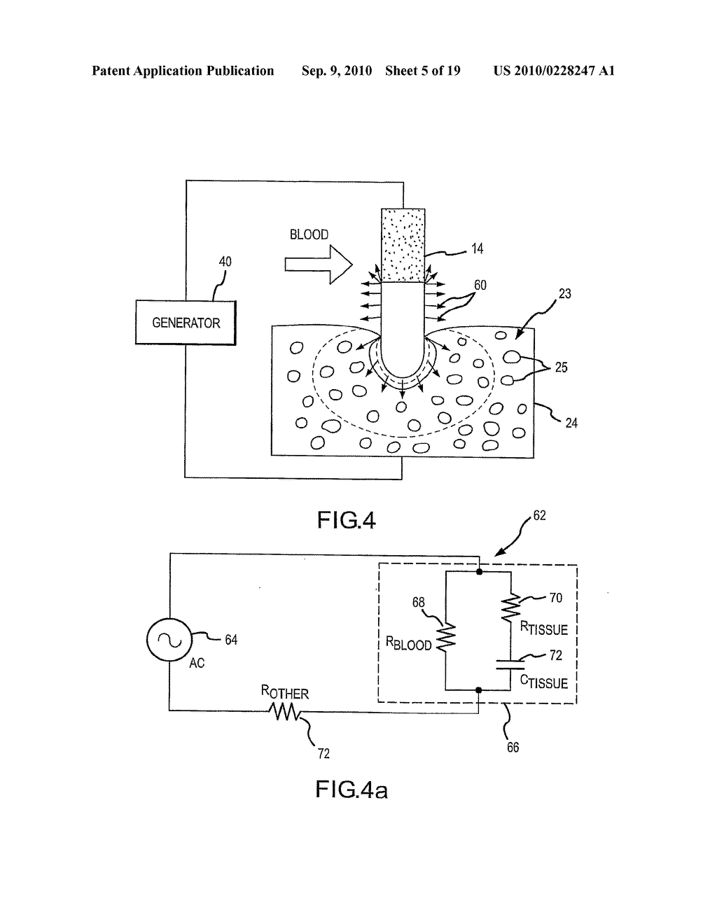 Assessment of electrode coupling of tissue ablation - diagram, schematic, and image 06