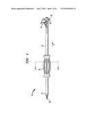 ACETABULAR SHELL REMOVAL INSTRUMENT diagram and image