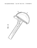 ACETABULAR SHELL REMOVAL INSTRUMENT diagram and image