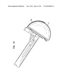 ACETABULAR SHELL REMOVAL INSTRUMENT diagram and image