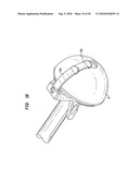 ACETABULAR SHELL REMOVAL INSTRUMENT diagram and image