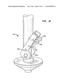 ACETABULAR SHELL REMOVAL INSTRUMENT diagram and image