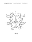 SYSTEM AND METHOD FOR PROTECTING NEUROVASCULAR STRUCTURES diagram and image