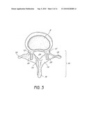 SYSTEM AND METHOD FOR PROTECTING NEUROVASCULAR STRUCTURES diagram and image