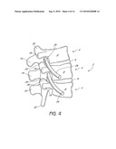 SYSTEM AND METHOD FOR PROTECTING NEUROVASCULAR STRUCTURES diagram and image