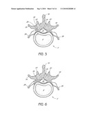 SYSTEM AND METHOD FOR PROTECTING NEUROVASCULAR STRUCTURES diagram and image