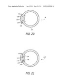 SYSTEM AND METHOD FOR PROTECTING NEUROVASCULAR STRUCTURES diagram and image