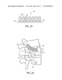 SYSTEM AND METHOD FOR PROTECTING NEUROVASCULAR STRUCTURES diagram and image