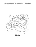 ANTERIOR PLATING SYSTEM AND METHOD diagram and image