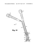 ANTERIOR PLATING SYSTEM AND METHOD diagram and image