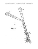 ANTERIOR PLATING SYSTEM AND METHOD diagram and image