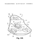 ANTERIOR PLATING SYSTEM AND METHOD diagram and image