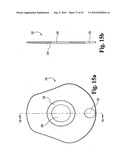 ANTERIOR PLATING SYSTEM AND METHOD diagram and image