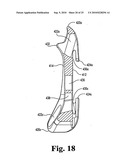 ANTERIOR PLATING SYSTEM AND METHOD diagram and image