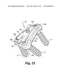 ANTERIOR PLATING SYSTEM AND METHOD diagram and image