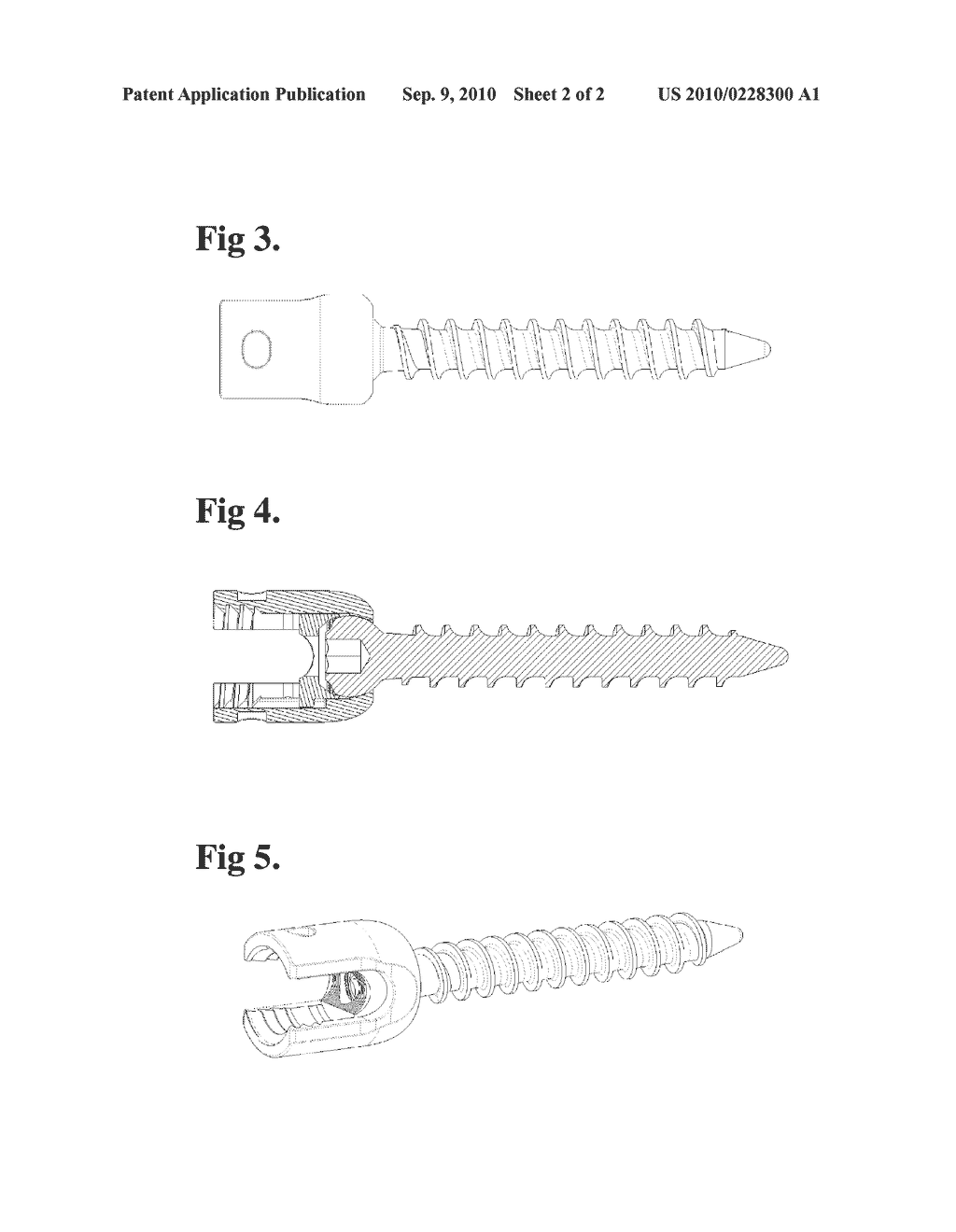 Radiosurgery Compatible Bone Anchor - diagram, schematic, and image 03