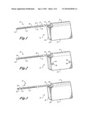 Method of Implanting a Subcutaneous Defibrillator diagram and image