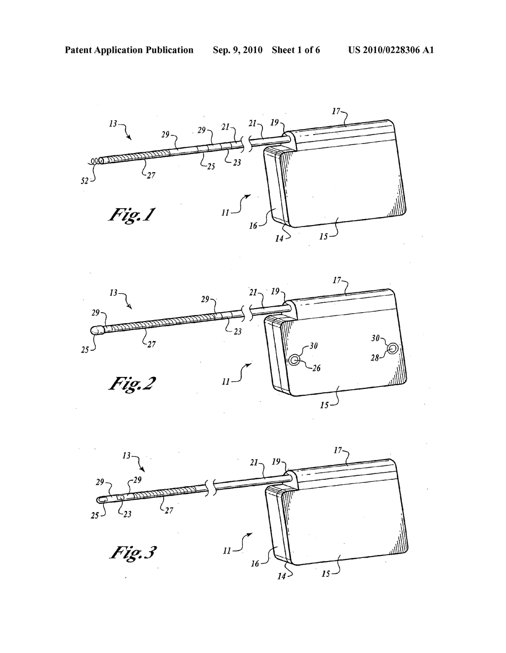 Method of Implanting a Subcutaneous Defibrillator - diagram, schematic, and image 02