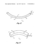 Method of Implanting a Subcutaneous Defibrillator diagram and image