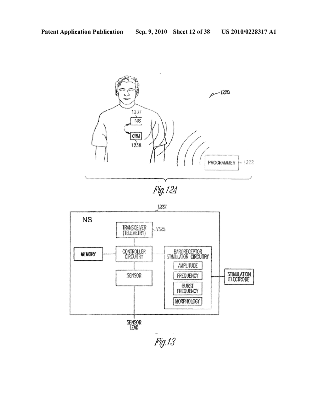 ADAPTIVE BAROREFLEX STIMULATION THERAPY FOR DISORDERED BREATHING - diagram, schematic, and image 13