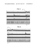 Electrical Stimulation Treatment of Bronchial Constriction diagram and image