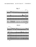 Electrical Stimulation Treatment of Bronchial Constriction diagram and image