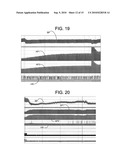 Electrical Stimulation Treatment of Bronchial Constriction diagram and image