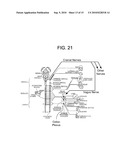 Electrical Stimulation Treatment of Bronchial Constriction diagram and image