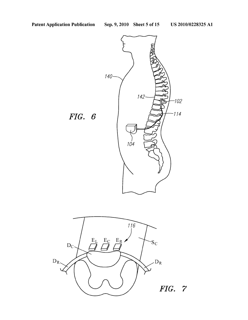 SHORT DURATION PRE-PULSING TO REDUCE STIMULATION-EVOKED SIDE-EFFECTS - diagram, schematic, and image 06