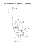 LEAD CONFIGURED FOR HISIAN, PARA-HISIAN, RV SEPTUM AND RV OUTFLOW TRACT PACING diagram and image