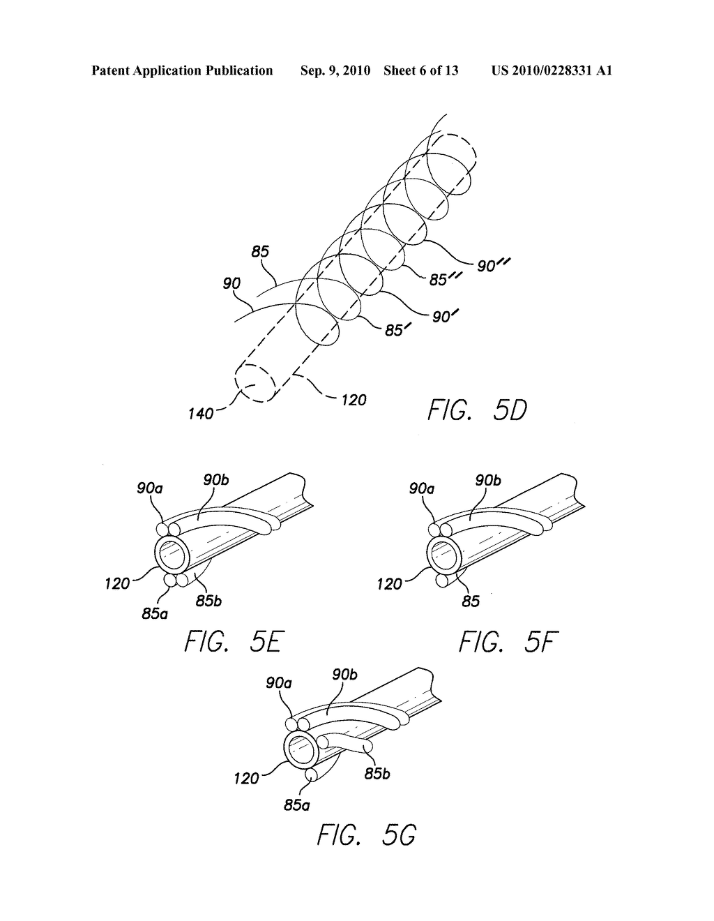 IMPLANTABLE MEDICAL LEAD HAVING A BODY WITH HELICAL CABLE CONDUCTOR CONSTRUCTION AND METHOD OF MAKING SAME - diagram, schematic, and image 07