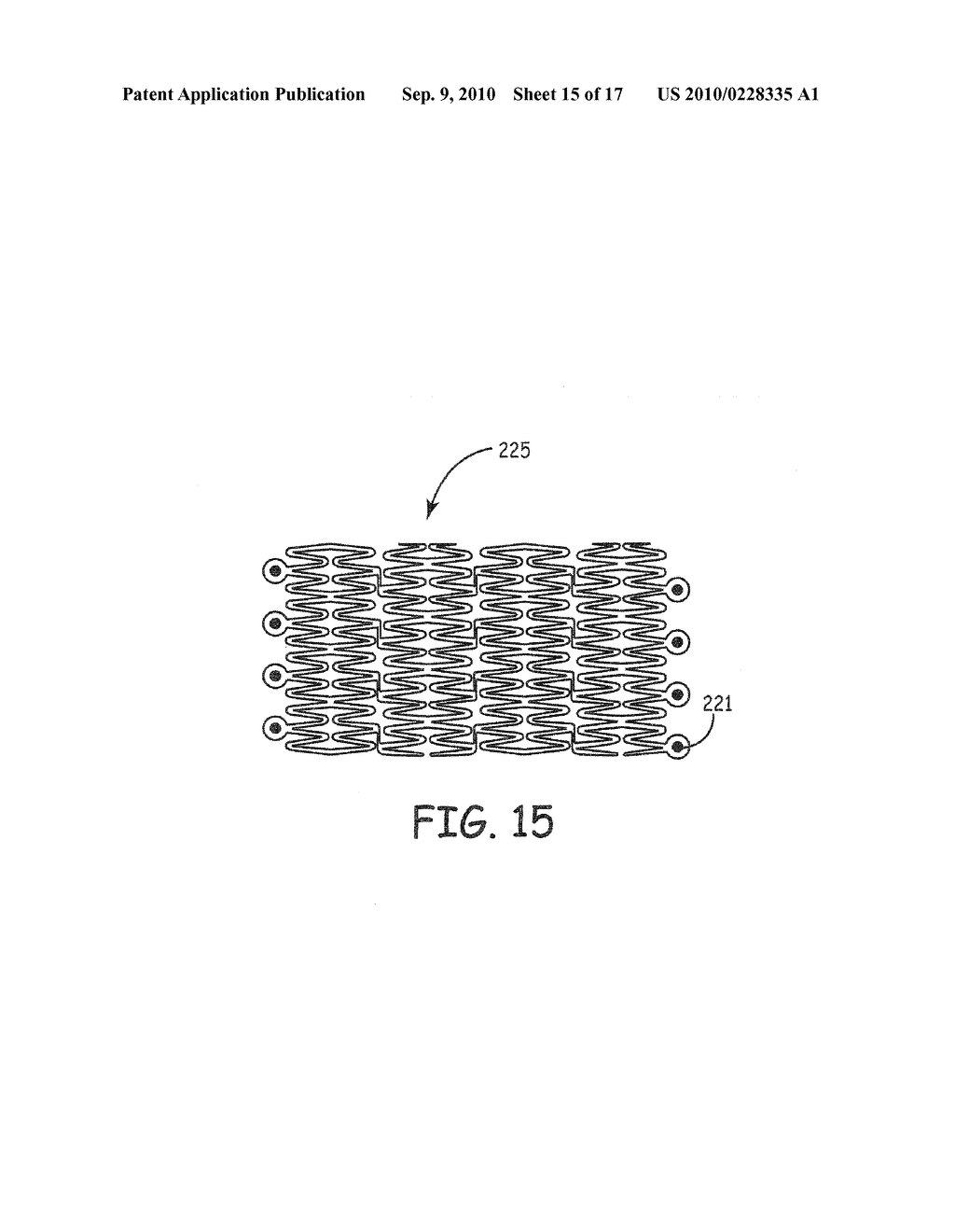 STENTS MODIFIED WITH MATERIAL COMPRISING AMNION TISSUE AND CORRESPONDING PROCESSES - diagram, schematic, and image 16